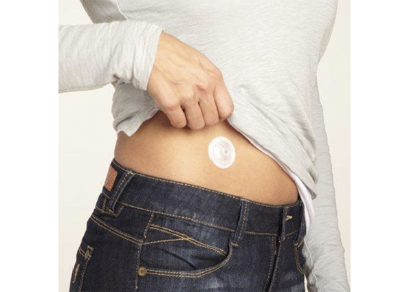 port d’injection Minimed i-Port Advance™