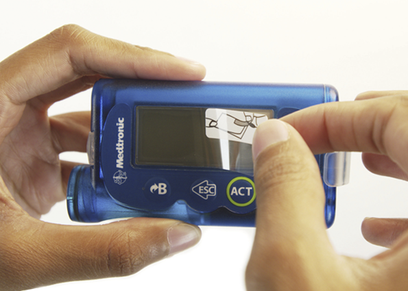 Film de protection - MiniMed