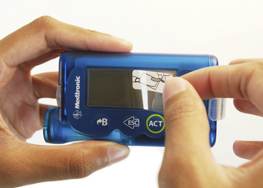 Film de protection - MiniMed